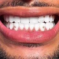 Beautiful smile showing multiple tooth gems